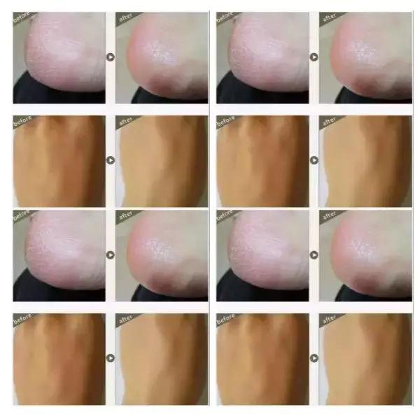 用了身体乳皮肤变好,用了身体乳皮肤特别嫩