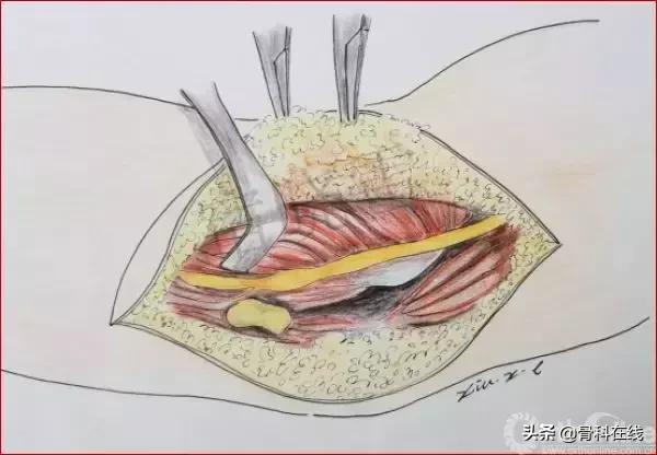 手绘科普类,手绘类科普