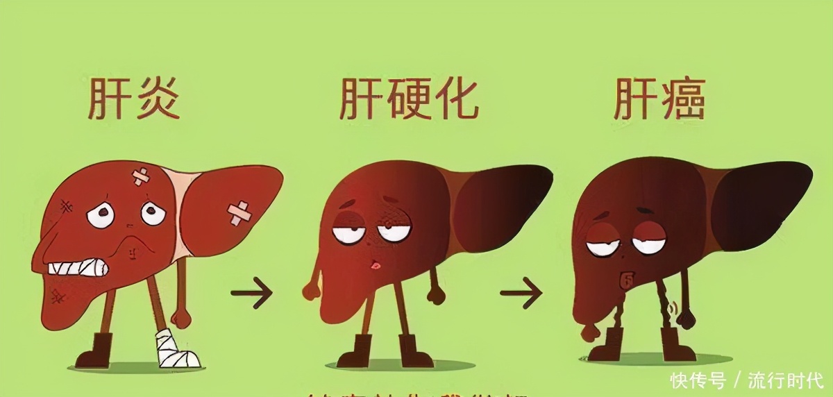 抗乙肝病毒效果好为什么还是肝癌,已经在吃乙肝抗病毒药是否预防hiv