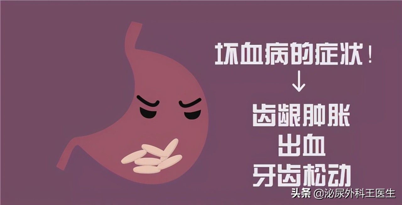 治疗男性ed的维生素是什么,粥样动脉硬化补充维生素c