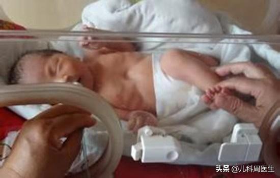 儿童喉炎犬吠样声音怎么治疗,犬吠样咳嗽吸气性喉鸣处理方法