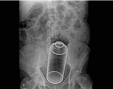 不作死就不会死看看你中了几条,不作死就不会死让人看的头皮发麻
