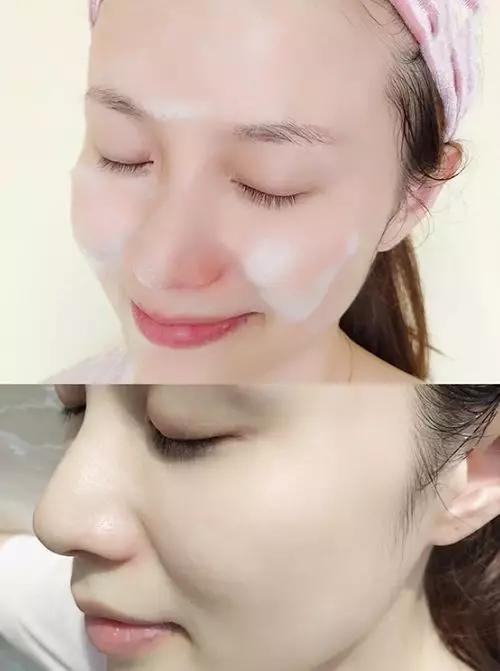 脸上长痘痘的原因和注意事项,脸上长痘痘到底应该怎么解决