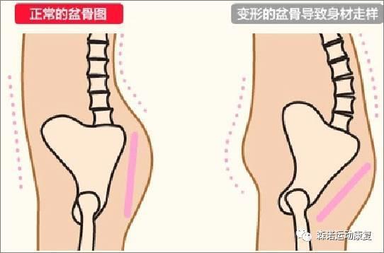 产后腰疼、赘肉、漏尿，是不是“坐月子”落下的病？