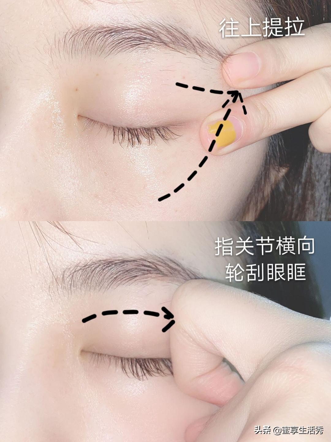 内双眼皮怎么变外双按摩最有效,内双眼皮手术变外双效果