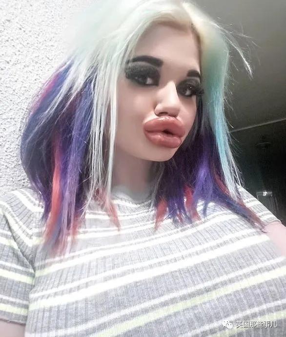 20次整容成功的女人,20次丰唇