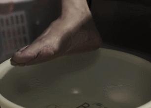 手脚干裂皮肤又厚又痒怎么办,冬天手脚干裂起皮怎么治疗