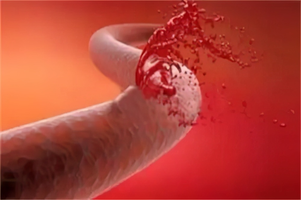 血小板减少会怎样后果,血小板减少吃啥药