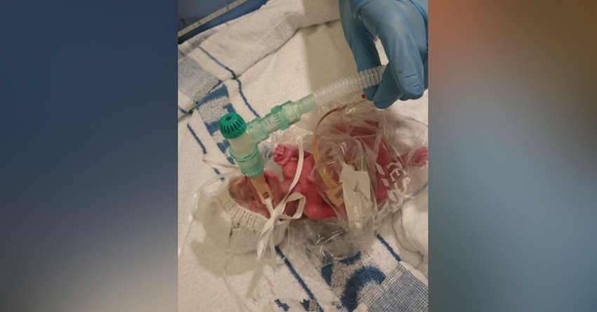 3.7斤早产儿终于长大了,早产儿从3.5斤长到4斤大概要好久