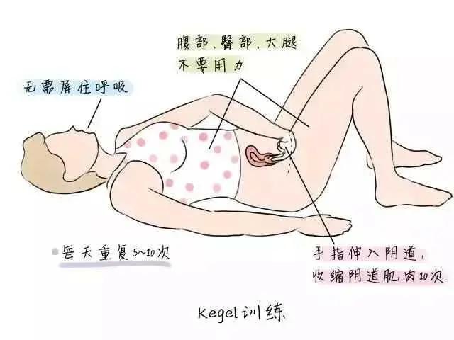 产后盆底肌放松不好,盆底肌松垮漏尿