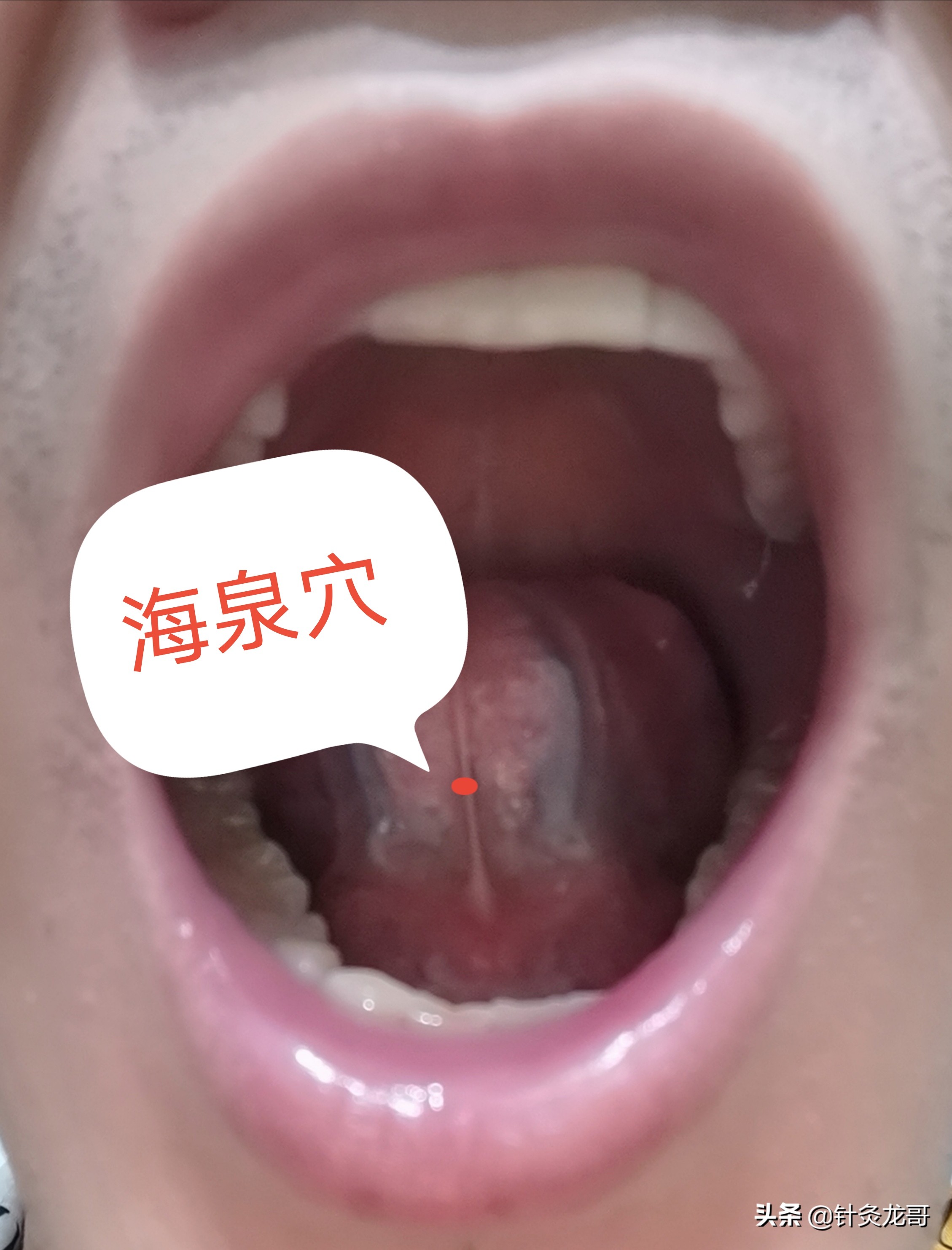 人体带海的穴位有几个,有关海的穴位