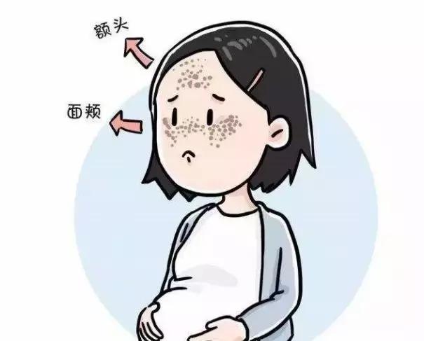 中药祛斑真的能去掉脸上的斑吗,脸上长斑怎么祛斑最有效的方法