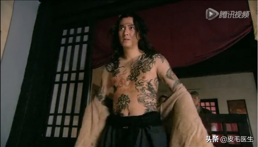 忍不住想给梁山好汉，送一台激光治疗仪