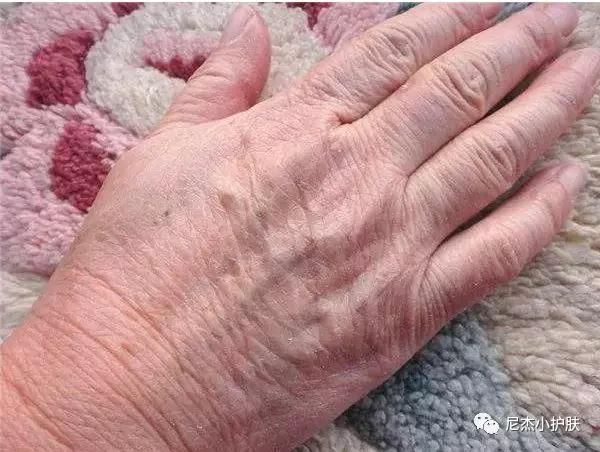 手粗糙怎么办教你一招就变好看,手部粗糙难看教你一招嫩白法