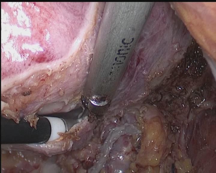 娓崡甯傜浜屽尰闄㈣偪鐦よ兏澶栫,鑲跨槫鍖婚櫌鑳镐簩澶栫