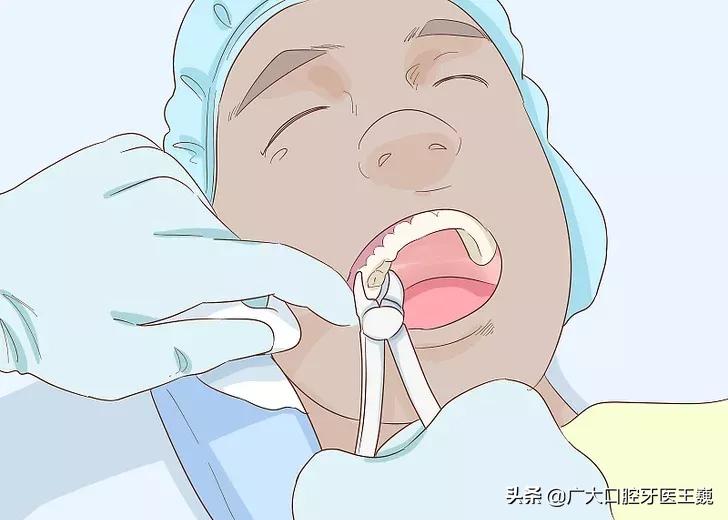 牙齿腐烂要怎么才能修复好,老人的牙齿全部腐烂怎么办