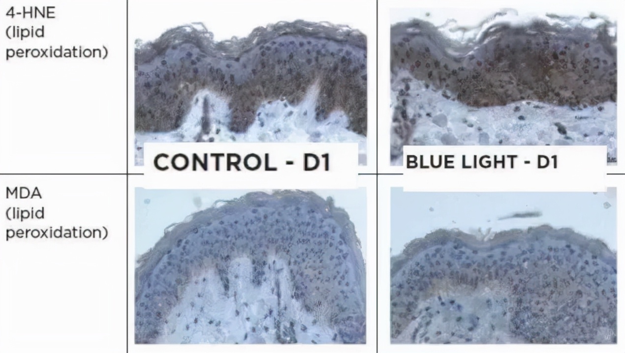 如何打造透亮质感的美肌,冬天美肌的最佳方法