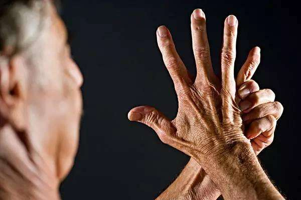 什么叫做痛风痛风有什么表现,痛风怎么得的痛风前兆脚疼