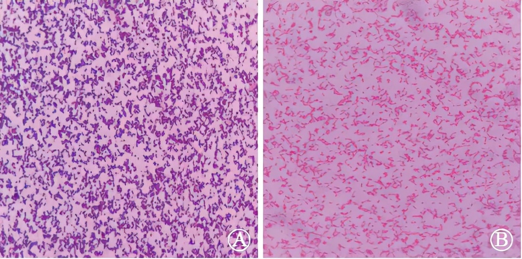 手术切口感染的主要病原菌是 (骨科一类切口感染原因分析)