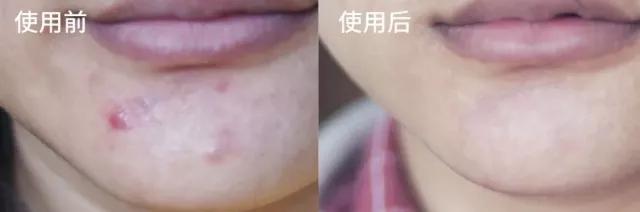 超临界蜂胶与普通蜂胶有几大优点,纯天然蜂胶的作用与功效