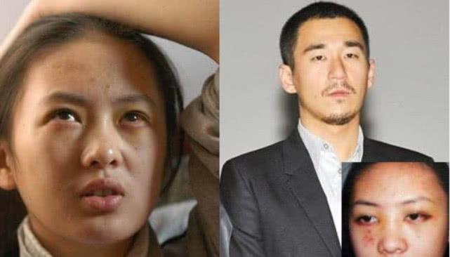 张默暴打童瑶事件后续,张默打童瑶事件瞬间