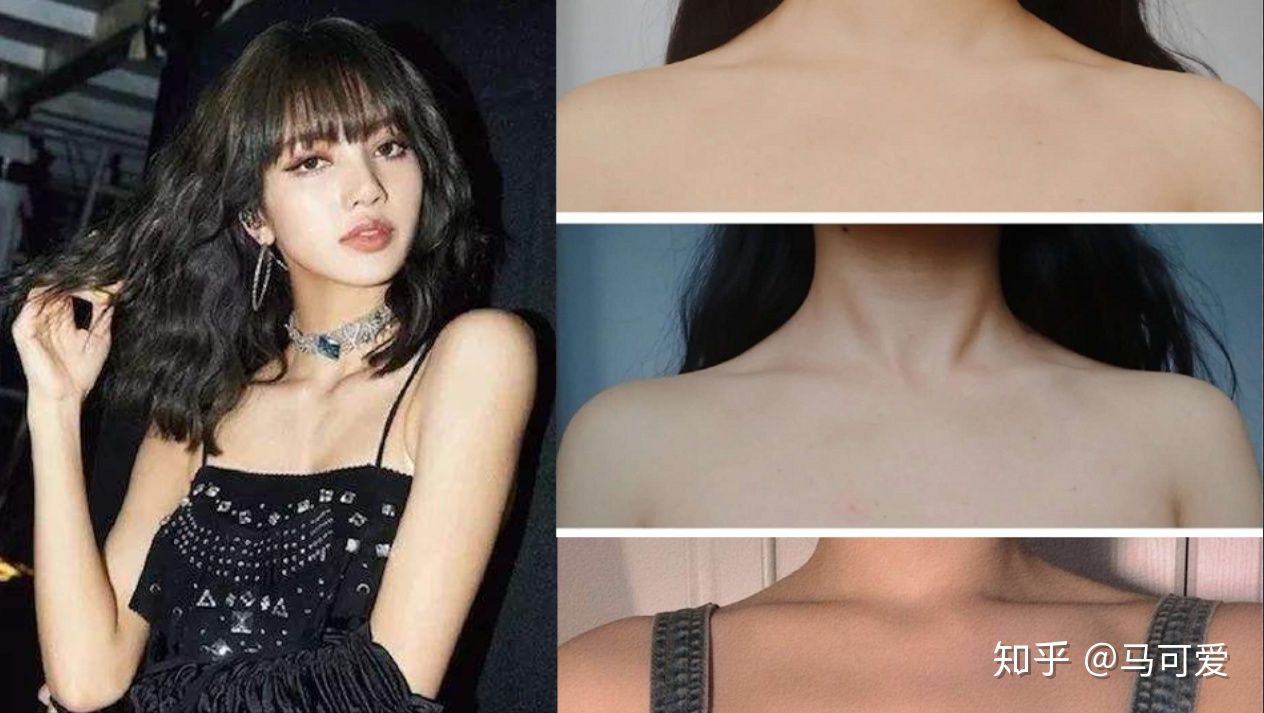 lisa的肩膀是直角肩吗,lisa的直角肩给她带来什么病