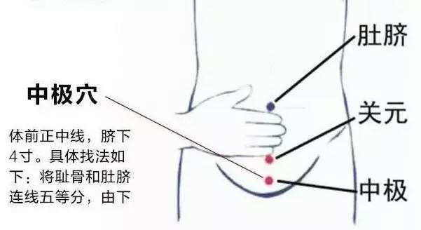 上呼吸道感染发热可以艾灸吗,泌尿感染发热寒战怎么办