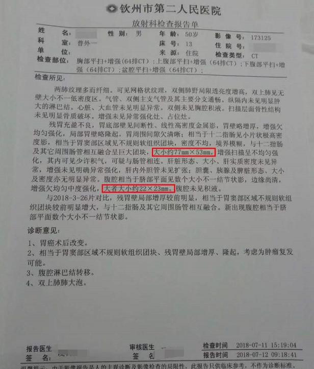 莫先生住院,胃癌手术患者术后恢复得挺好