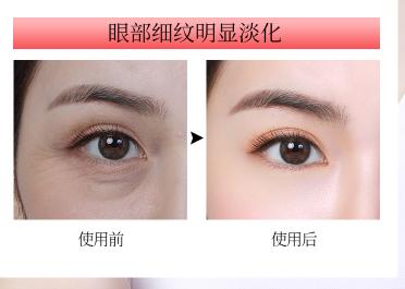 李佳琦推荐5款美容仪,李佳琦推荐的平价国货美容仪