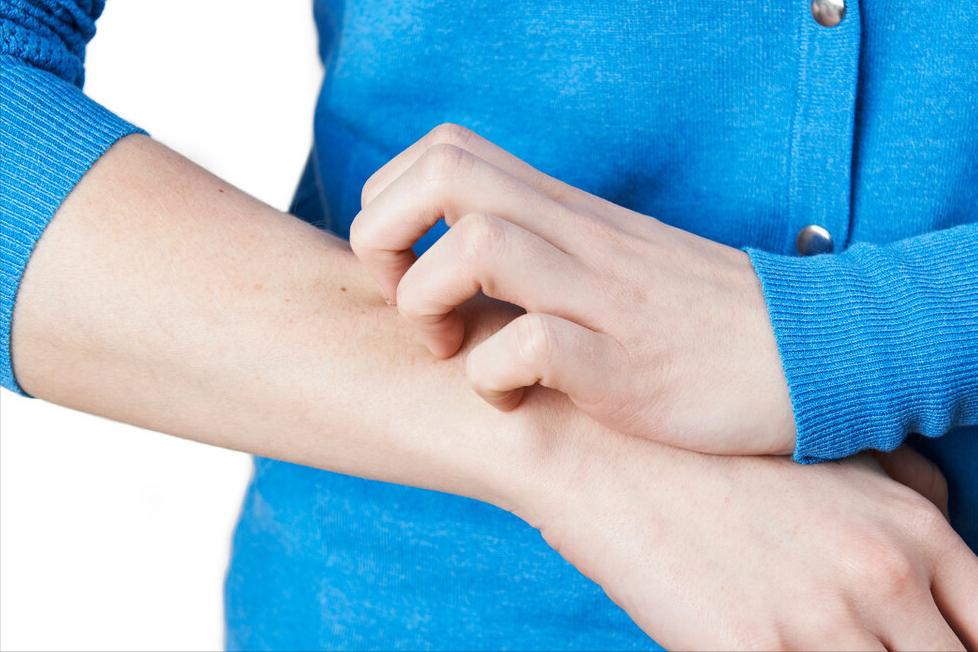 夏季荨麻疹高发期如何应对,麻疹最快的解决方法