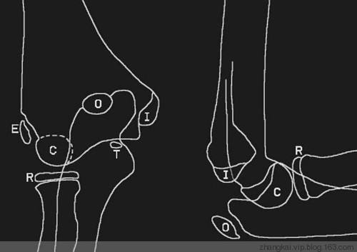 如何学习骨科康复治疗,骨科科普宣教小知识