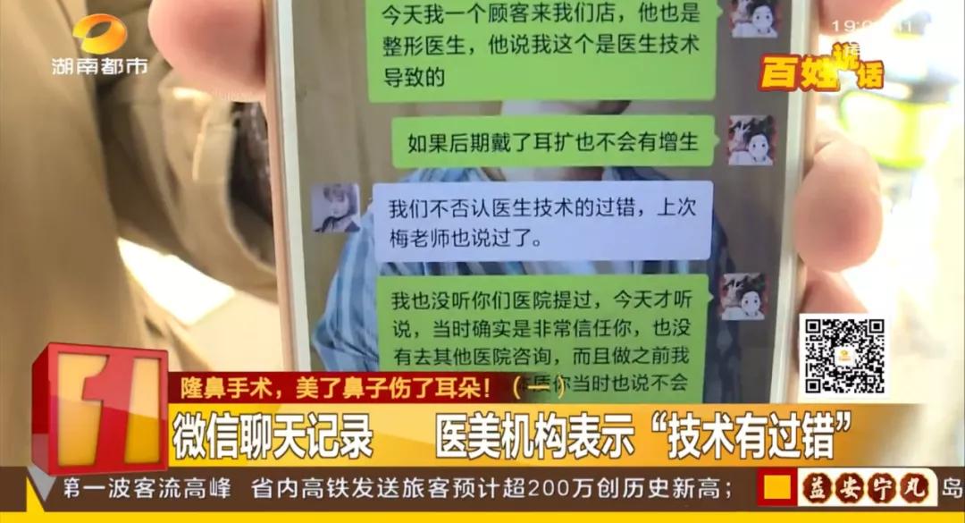 隆鼻微整形需谨慎,隆鼻整容需谨慎