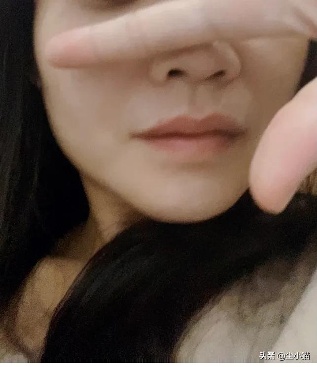 下巴长痘能不能挤,祛痘的真相