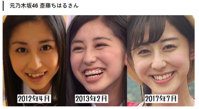 牙齿不整齐的日本女孩,日本人牙齿不齐怎么回事