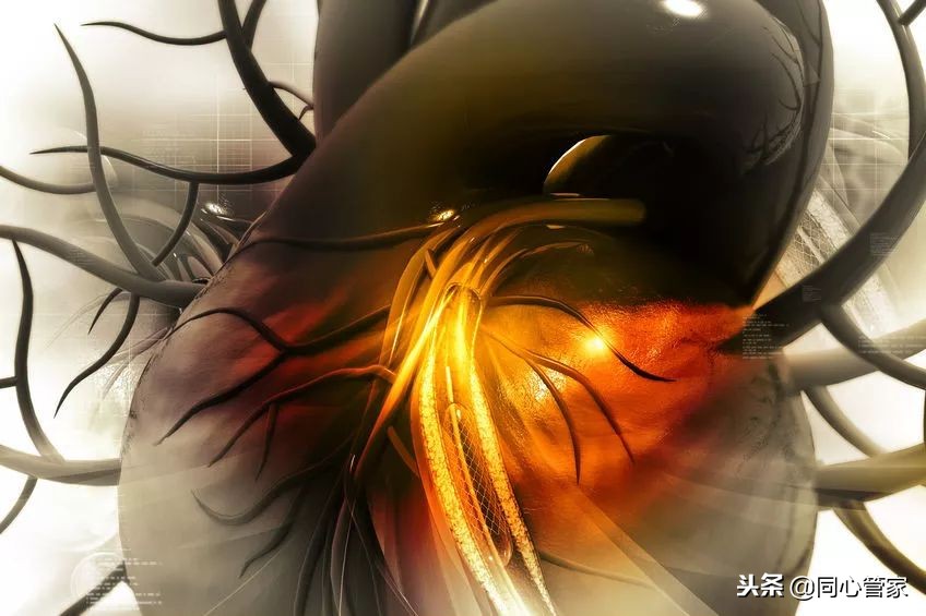 不想搭桥是否可以保守治疗,年轻人心梗支架与溶栓哪个好