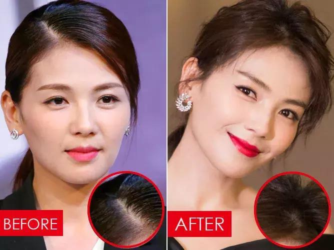 张歆艺防止妊娠纹,张歆艺预防妊娠纹