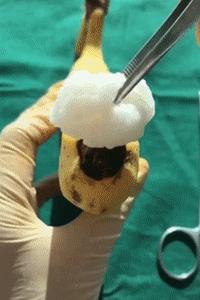 几个月的男宝需要清洗包皮吗,男宝多大开始洗包皮