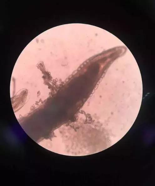 4岁小女孩屁屁痒,妈妈脱下裤子检查后吓坏了:一粒粒竟还会动