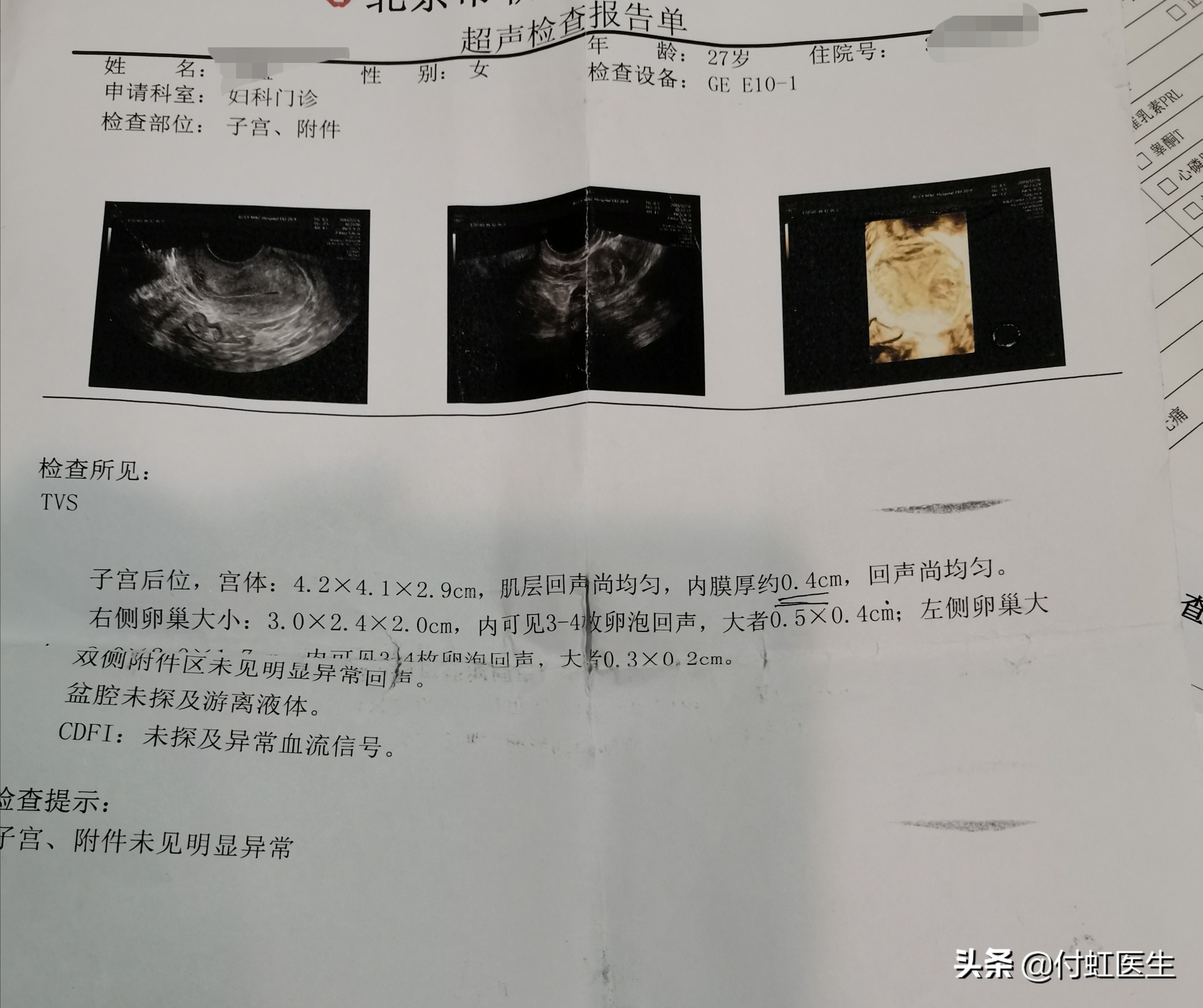 27岁卵巢功能早衰,27岁卵巢早衰50岁会怎么样