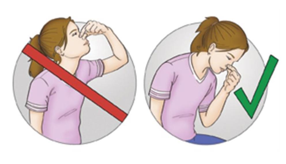 打喷嚏流鼻血有什么常用药,打喷嚏流鼻血用什么方法止血最快