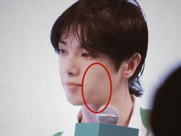 华晨宇植发的医院是哪里,华晨宇植发图片是真的吗