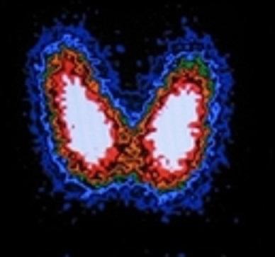 居里夫妇、镭、“派特洗梯”（PET/CT），与医学影像有什么关系？