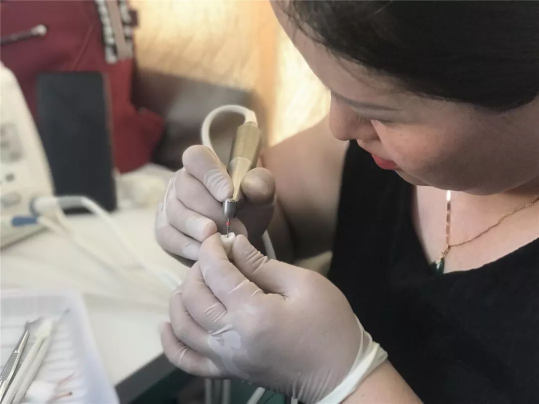 青岛西海岸中心医院根管治疗,青岛西海岸骨干培训班