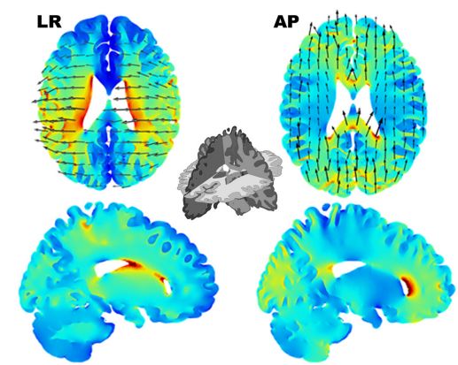 癌细胞电场疗法,内置电场杀死癌症细胞
