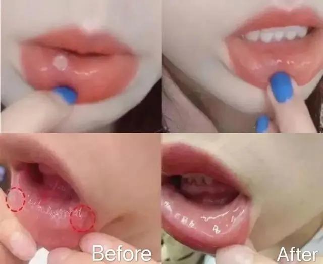 一张嘴臭牙齿就臭怎么办,一张嘴就口臭小妙招