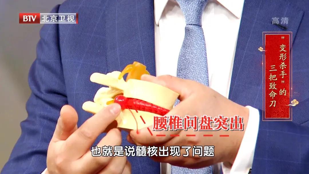 腰椎其中一节变形最好的治疗方法,腰椎轻度变形怎么治