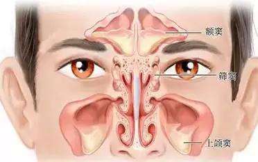 鼻炎自愈的最佳办法盐水洗鼻,洗鼻后鼻炎的自愈办法