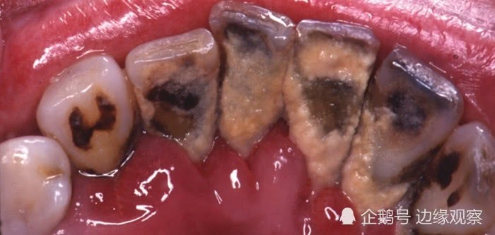 韩国烟包装为什么那么吓人,韩国新型香烟