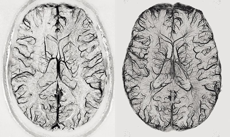 人类最完整大脑三维图像出炉,人类大脑最完整的三维立体图像