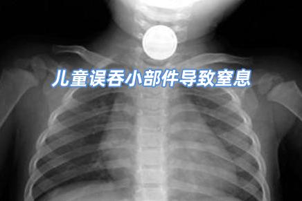 童装买前注意事项有哪些,买童装要注意哪些问题